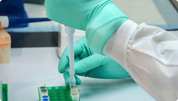 Phẫu thuật điều trị hẹp khúc nối bể thận – niệu quản